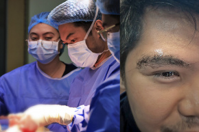 Patient’s vision restored, brain tumor removed through eyebrow surgery at The Medical City