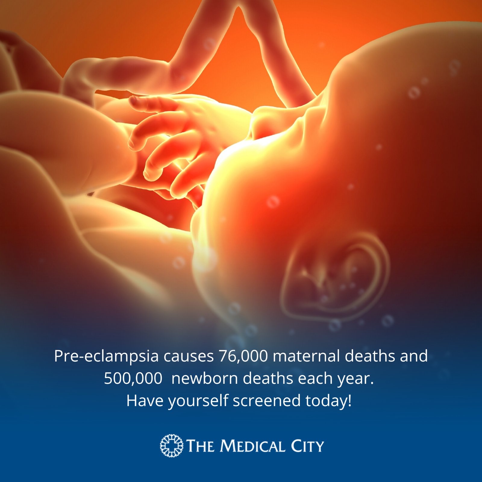 pre-eclampsia info