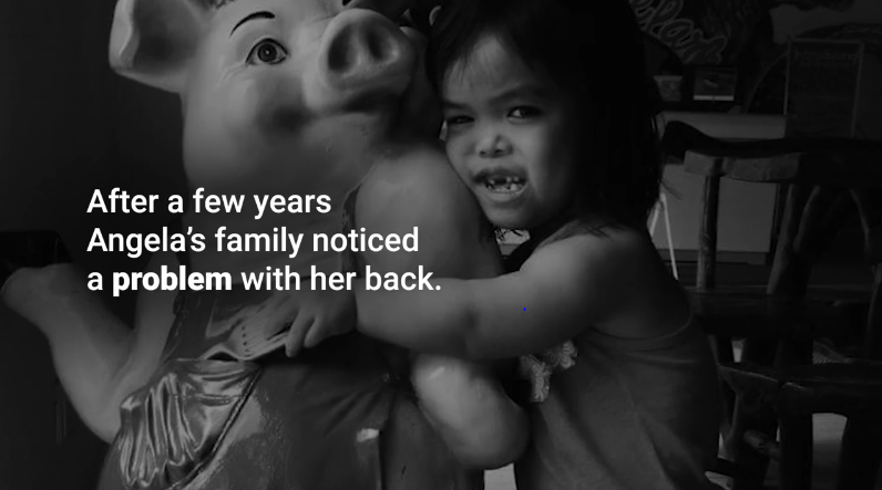 A New Beginning for Angela | An Integrated Spine Program Story