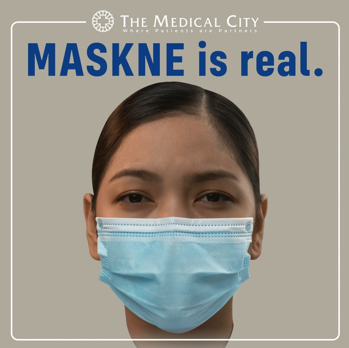 maskne is real